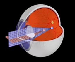 散光眼睛是因为眼球表面不光滑导致光线进入球内时形成不同的落点