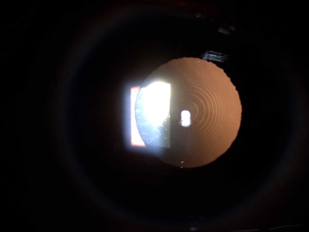 环形多焦点人工晶体矫正近视力或远视力，散光和老花。